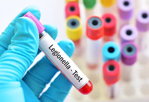 Tratamiento Legionella